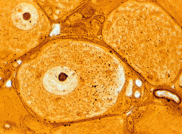Dorsal root ganglion, light micrograph Light micrograph showing pseudounipolar neurons of a dorsal root ganglion. At centre, the large neuronal cell body is surrounded by satellite glial cells and shows a nucleus with a large nucleolus. The axon, the only process of this neuron, can be seen leaving the right side of the soma. Plastic embedded material 0.5 micrometre thick section, silver stained., by JOSE CALVO   SCIENCE PHOTO LIBRARY