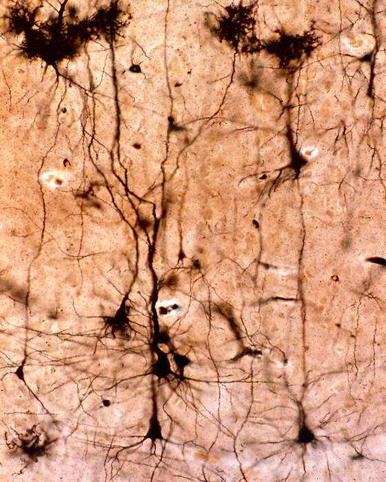 Cerebral cortex pyramidal neurons, light micrograph Light micrograph of pyramidal neurons of the cerebral cortex stained with the Golgi silver chromate. A large apical dendrite and multiple basal dendrites originate from the conical shaped soma., by JOSE CALVO   SCIENCE PHOTO LIBRARY