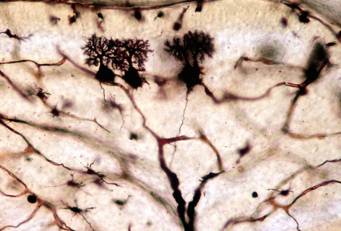 Developing Purkinje cells, light micrograph Light micrograph showing immature Purkinje neurons in a developing cerebellar cortex. The Purkinje cell dendrites cannot reach the surface of cerebellar cortex because there is a thick external granular layer containing the cerebellar granule neuron progenitors., by JOSE CALVO   SCIENCE PHOTO LIBRARY