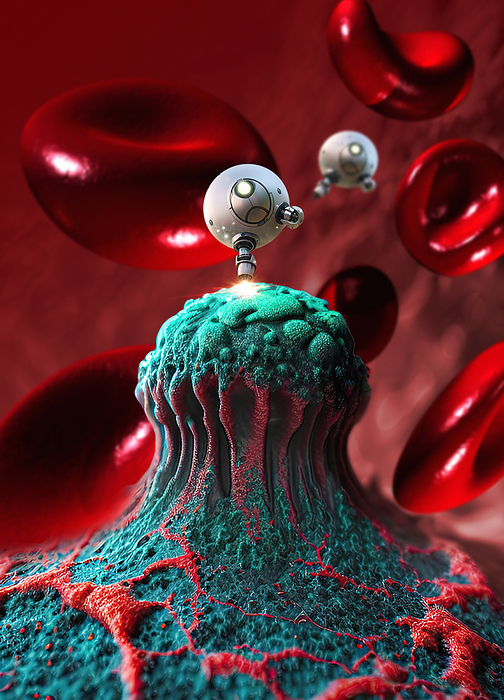 Medical nanorobots, illustration Illustration showing medical nanorobots travelling inside the human body. This emerging technology is being investigated for an array of biomedical tasks, such as diagnostics, therapeutic interventions and targeted drug delivery., by VICTOR HABBICK VISIONS SCIENCE PHOTO LIBRARY