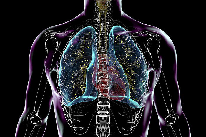 Lung adiaspiromycosis, illustration Lung adiaspiromycosis, illustration., by KATERYNA KON SCIENCE PHOTO LIBRARY