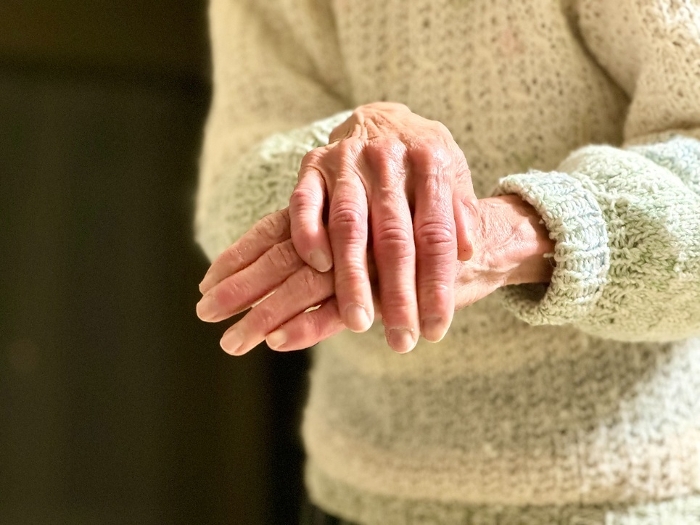 Elderly woman's hand rubbing the back of her hand