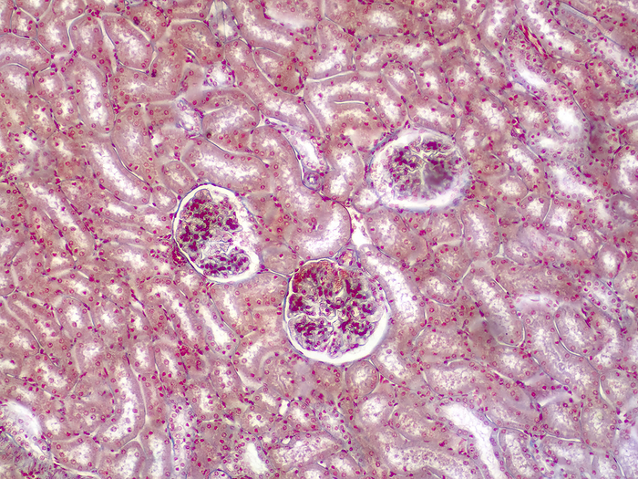 Human kidney, light micrograph Human kidney, light micrograph., by CHOKSAWATDIKORN   SCIENCE PHOTO LIBRARY