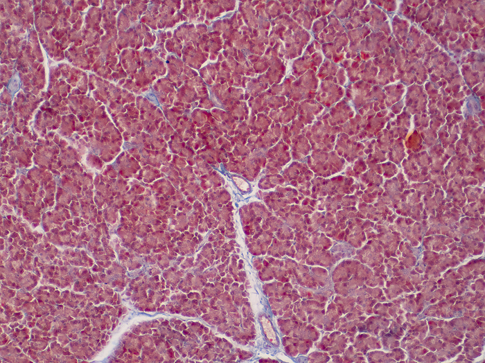 Human liver tissue, light micrograph Human liver tissue, light micrograph., by CHOKSAWATDIKORN   SCIENCE PHOTO LIBRARY