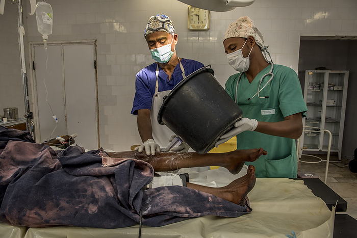 Post surgery care Washing a woman following a medical procedure at Lemlem Karl Hospital in Maichew Town, part of Ethiopia s Tigray region. follows safe surgery practices to prevent infection after operations. by KAREN KASMAUSKI SCIENCE PHOTO LIBRARY