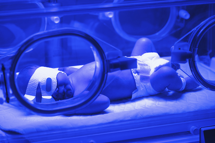 Canada Newborn Baby In An Incubator With Blue Light For Jaundice In The Hospital  Alberta, Canada, by John Kroetch   Design Pics