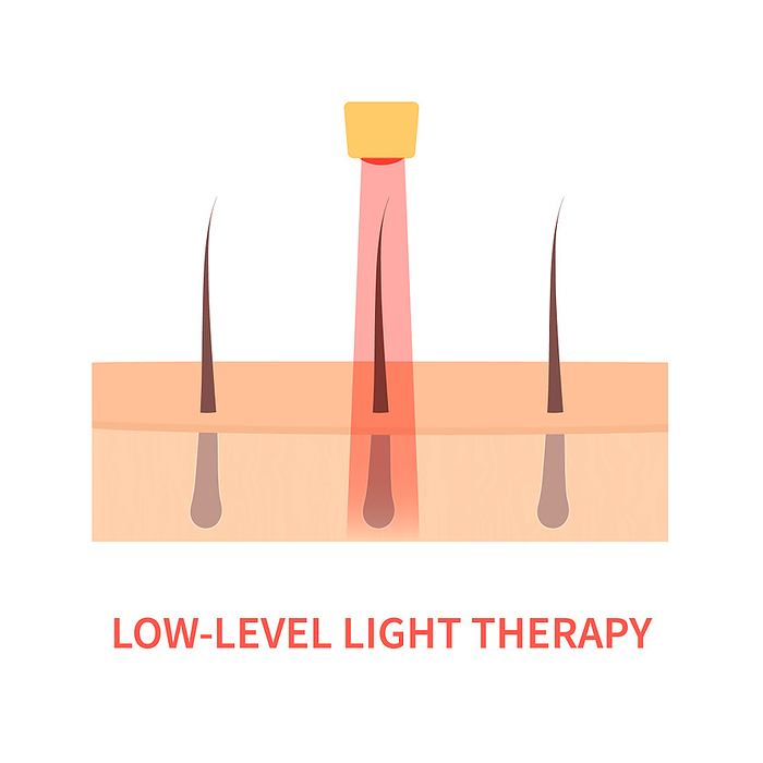 Light therapy, conceptual illustration Light therapy, conceptual illustration., by ART4STOCK SCIENCE PHOTO LIBRARY