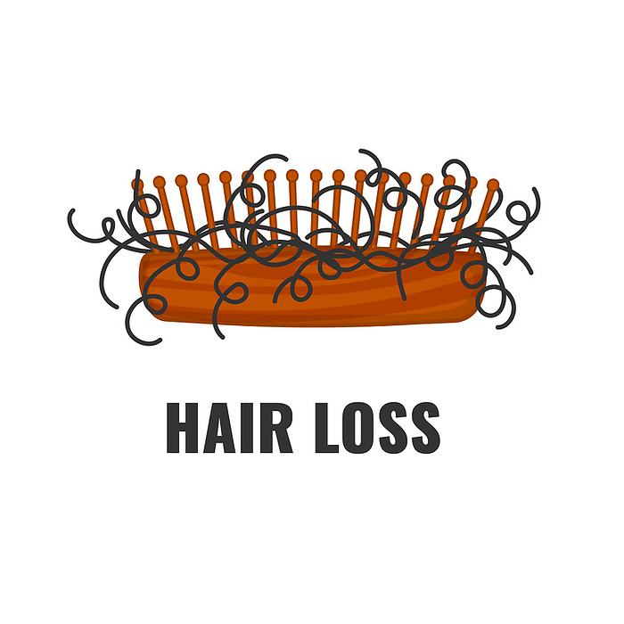 Hair loss, conceptual illustration Hair loss, conceptual illustration., by ART4STOCK SCIENCE PHOTO LIBRARY