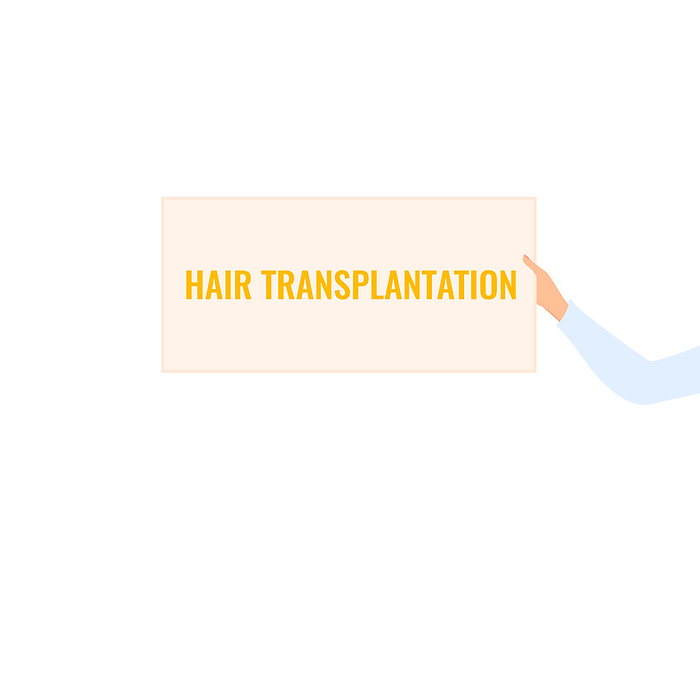 Hair transplantation, conceptual illustration Hair transplantation, conceptual illustration., by ART4STOCK SCIENCE PHOTO LIBRARY
