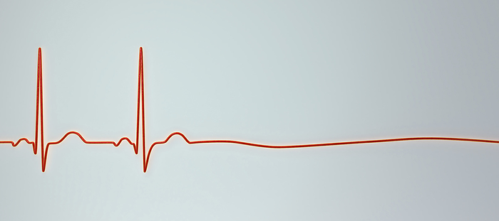 Asystole cardiac arrest, illustration Illustration showing a flatline on an electrocardiogram  ECG , signifying the critical condition known as asystole, where the heart s electrical system fails entirely and ceases to beat., by KATERYNA KON SCIENCE PHOTO LIBRARY