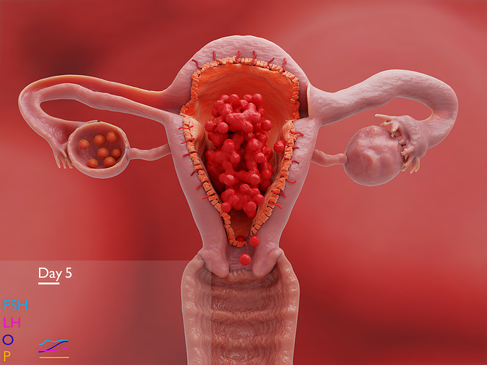 Uterus and ovaries on day 5 of the menstrual cycle, illustration Illustration of the uterus  centre  and ovaries  centre right and left  on day five of the menstrual cycle, near the end of menstruation  bleeding . Once sexual maturity is reached up to 20 oocytes start developing into eggs  ovums  every menstrual cycle. Only one will reach full maturity as a Graafian follicle and release its egg at ovulation. The follicle then develops into a corpus luteum, which secretes progesterone to build up the endometrium, the bloody lining of the uterus  red , ready for a fertilised egg. If there is no fertilised egg after 12 days it stops secreting and degenerates into a corpus albicans. Without progesterone the endometrium sloughs off  this is menstruation. The cycle can now start again. Levels of female sex hormone at this stage are shown at bottom left. They are follicle stimulating hormone  FSH , luteinising hormone  LH , oestrogen  O  and progesterone  P ., by JUAN GAERTNER SCIENCE PHOTO LIBRARY