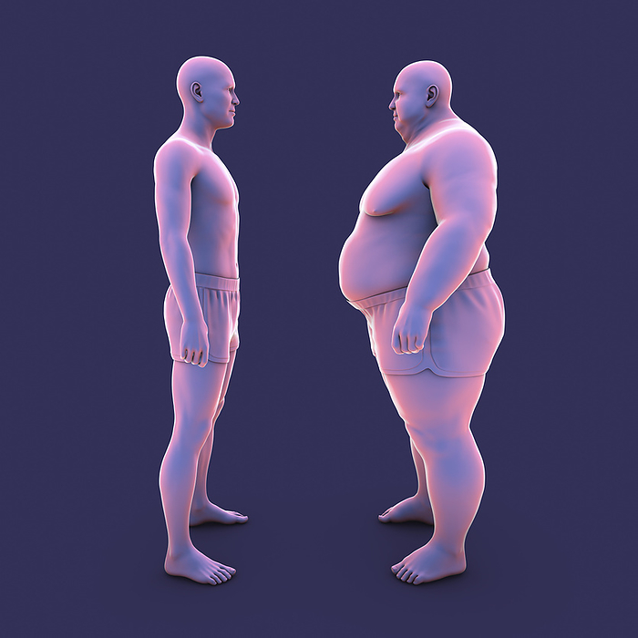 Average weight person and overweight person, illustration Illustration of an average weight person standing in next to an overweight person., by KATERYNA KON SCIENCE PHOTO LIBRARY