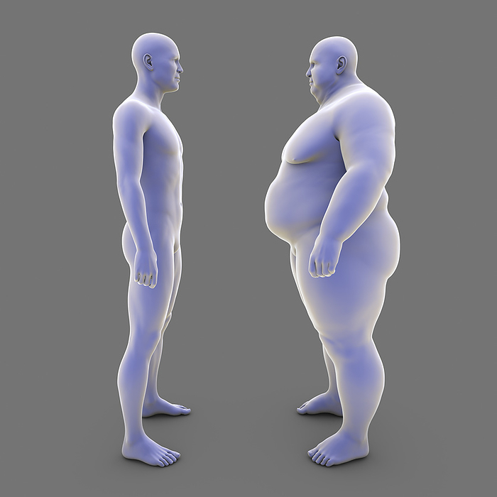 Average weight person and overweight person, illustration Illustration of an average weight person standing in next to an overweight person., by KATERYNA KON SCIENCE PHOTO LIBRARY