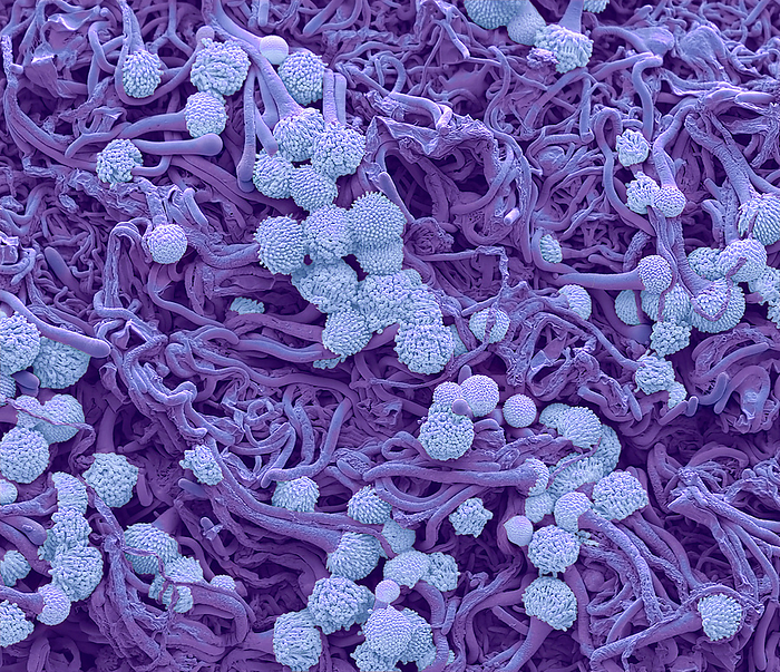 Drug resistant aspergillus, SEM Drug resistant aspergillus. Coloured scanning electron micrograph  SEM  of developing fruiting bodies  conidiophores  of azole resistant aspergillus fumigate. A. fumigatus can cause an invasive life threatening infection, called aspergillosis, in people who have weakened immune systems or have had transplants. Patients with severe cases of respiratory infections such as influenza or SARS CoV 2 have also developed aspergillosis. Triazole antifungal drugs, commonly called azoles, are the primary treatment for aspergillosis. Azole resistant A. fumigatus infections are difficult to treat, and these patients are up to 33  more likely to die than patients with infections that can be treated with azoles. Magnification: x 600 when printed at 10cm wide. Specimen courtesy of Darius Armstrong James Professor of Infectious Diseases and Medical Mycology. Department of Microbiology, Imperial College, by STEVE GSCHMEISSNER SCIENCE PHOTO LIBRARY