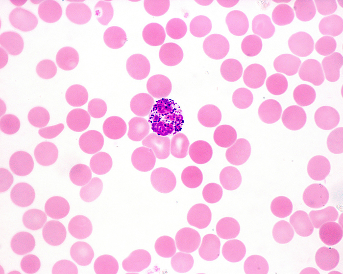 Basophil in blood smear, light micrograph Light micrograph of a human blood smear showing an basophil leukocyte, the least common type of granulocyte, representing about 0.5  to 1  of circulating white blood cells. Basophils contain large cytoplasmic blue granules, which obscure the cell nucleus under the microscope., by JOSE CALVO   SCIENCE PHOTO LIBRARY
