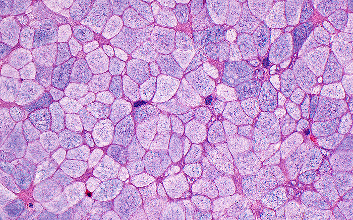 Sinus respiratory epithelium cells, light micrograph Light micrograph of respiratory epithelium, cut tangentially. The cells of the epithelium  surface lining  are filled with mucinous substance  pale white grey to light blue . The individual cells form intersecting polygonal shapes. The deeper layers of the epithelium are not seen in this image, as it has been cut tangentially and parallel to the horizontal plane of the epithelium. Haematoxylin and eosin stained tissue section. Magnification: 400x when printed at 10cm., by ZIAD M. EL ZAATARI SCIENCE PHOTO LIBRARY