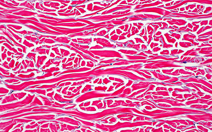 Skin dermis, light micrograph Light micrograph of the dermis. The dermis is the layer of normal skin that is beneath the epidermal surface lining. Here, the collagen bundles  thick red lines and chunks  making up the dermis can be seen. Haematoxylin and eosin stained tissue section. Magnification: 200x when printed at 10cm., by ZIAD M. EL ZAATARI SCIENCE PHOTO LIBRARY
