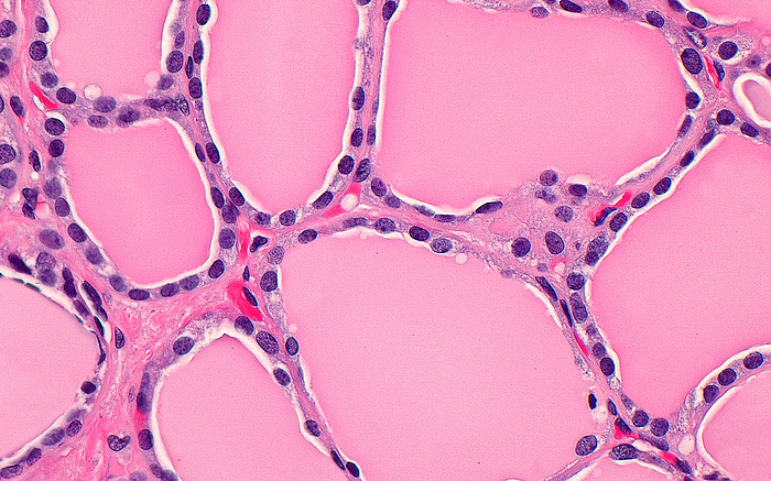 Thyroid follicles, light micrograph Light micrograph of thyroid follicles. The thyroid gland is composed of follicles  roughly round large structures  filled with colloid substance  pink  and lined by follicular cells  blue dots . A few blood vessels  bright red  are also seen in this image in between the follicles. Haematoxylin and eosin stained tissue section. Magnification: 400x when printed at 10cm., by ZIAD M. EL ZAATARI SCIENCE PHOTO LIBRARY