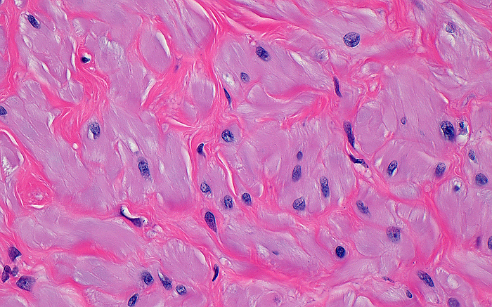Vas deferens smooth muscle, light micrograph Light micrograph of smooth muscle cells in the wall of a vas deferens. Groups of smooth muscle cells  pale pink  are surrounded by fibrous tissue  darker pink . The nuclei of the smooth muscle cells are the blue purple dots. Haematoxylin and eosin stained tissue section. Magnification: 400x when printed at 10cm., by ZIAD M. EL ZAATARI SCIENCE PHOTO LIBRARY