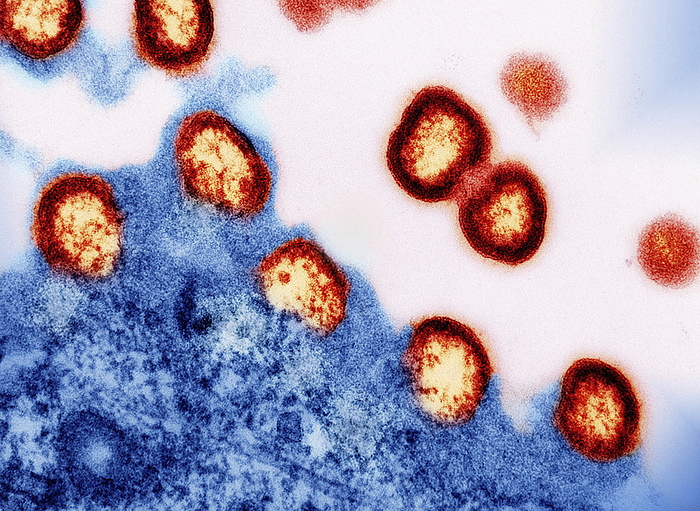 HIV 1 virus particles, TEM Coloured transmission electron micrograph  TEM  of HIV 1 virus particles  red  budding from the membrane of a T cell white blood cell  blue . Budding virus particles that have not yet separated from the cell appear as semi circles. HIV  human immunodeficiency virus  infects helper T cells, which are part of the body s immune system. HIV enters the cell and replicates, before destroying the cell as the new viruses emerge through its membrane. Eventually this severely weakens the immune system, causing AIDS  acquired immunodeficiency syndrome ., by NATIONAL INSTITUTES OF HEALTH, NIAID SCIENCE PHOTO LIBRARY