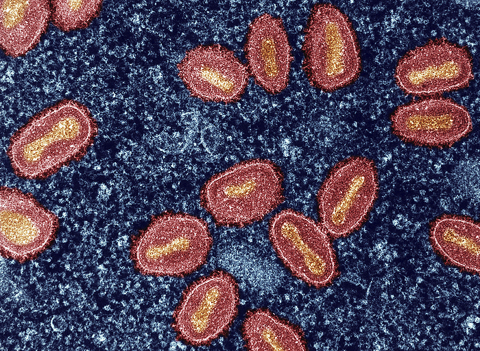 Mpox virus particles, TEM Coloured transmission electron micrograph  TEM  of mpox  previously monkeypox  virus particles  red  within an infected cell  blue . In humans mpox infection causes fever, fatigue, body aches, swollen glands and a rash of fluid filled blisters. Transmission can occur through direct contact with infectious skin or other lesions, bites or scratches from infected animals, or indirectly through contact with contaminated objects. The mpox virus was first discovered in 1958 in two outbreaks of a pox like disease among colonies of research monkeys, though small mammals such as rodents are believed to be the natural hosts. The first human case was recorded in 1970 in the Democratic Republic of the Congo, and it is endemic in central and western Africa. Most people recover from mpox infection within 2 4 weeks, and a vaccine is available., by NIAID SCIENCE PHOTO LIBRARY