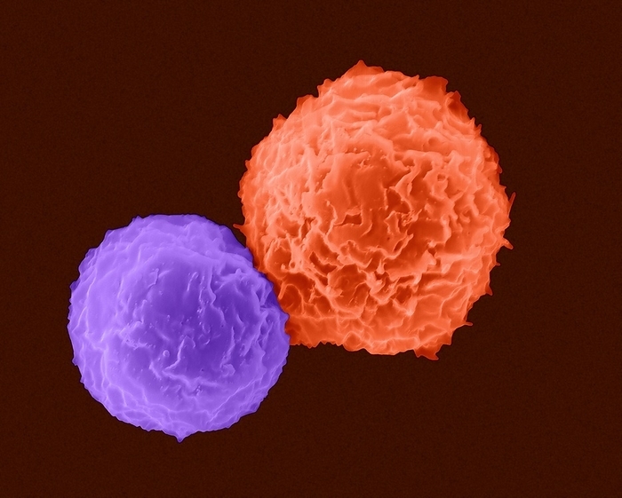 Helper T cell and B cell, SEM Helper T cell  small cell  and B cell  large cell , coloured scanning electron micrograph  SEM . Both cells are specialized immune response cells  lymphocytes . Helper T cells are derived from the thymus. The helper and killer T cells exit and pass back into the bloodstream, ready to battle antigens. B cells reach their full antigen fighting potential in the lymph nodes and spleen where antigens  foreign material  are filtered. When Helper T cells detect the presence of specific antigens, they produce various secretions that signal other cells to multiply and attack. Helper T cells instruct B cells to start making antibody producing plasma cells and memory B cells. Helper T cells also foster the production of cytotoxic, or killer T cells. Helper T cells can also release interleukin which stimulates other T cells. B cells can also digest the foreign material. Magnification: x2,000 when shortest axis printed at 25 millimetres., by DENNIS KUNKEL MICROSCOPY   SCIENCE PHOTO LIBRARY