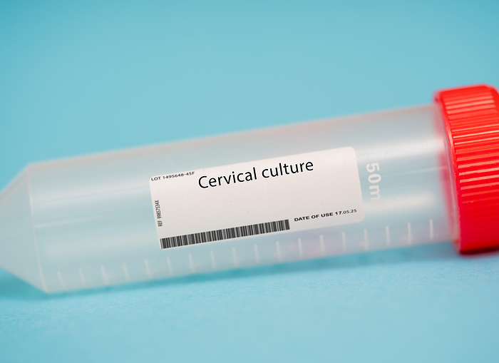 Cervical culture Cervical culture. A cervical culture is a test that is used to identify the presence of bacteria or other microorganisms that may be causing an infection in the cervix. A sample of cervical mucus is collected and sent to a laboratory for analysis., by WLADIMIR BULGAR SCIENCE PHOTO LIBRARY