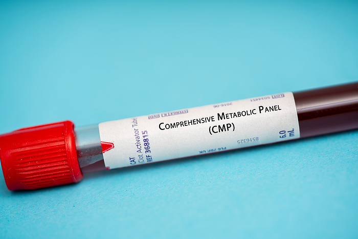 Comprehensice metabolic panel test Comprehensive metabolic panel  CMP . This test measures the same electrolytes and chemicals as the BMP, but also includes liver function test and test for total protein and albumin., by WLADIMIR BULGAR SCIENCE PHOTO LIBRARY