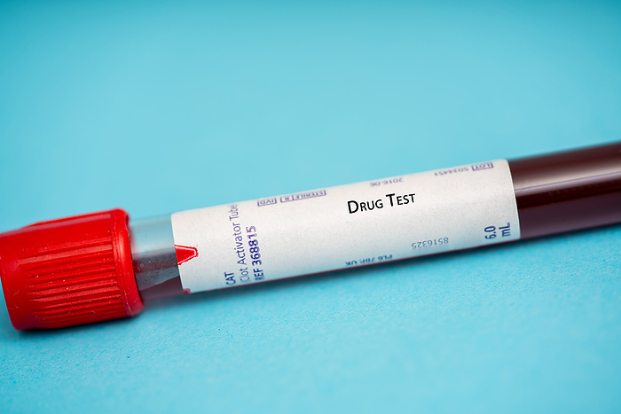 Drug test Drug test. These tests measure the presence of drugs or their metabolites in the blood. They are used to monitor medication levels, detect drug abuse, or assess drug interactions., by WLADIMIR BULGAR SCIENCE PHOTO LIBRARY