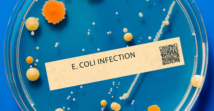 E coli infection E. coli infection. This is a bacterial infection that can cause diarrhoea, kidney failure, and other severe illnesses., by WLADIMIR BULGAR SCIENCE PHOTO LIBRARY