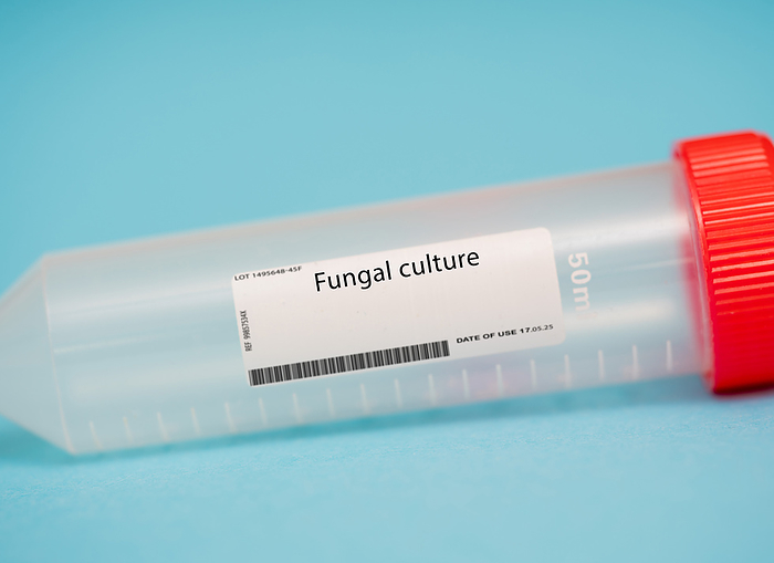 Fungal culture Fungal culture. A fungal culture is a diagnostic test that is used to identify the presence of fungal infections in the vagina. A sample of vaginal discharge is collected and sent to a laboratory for analysis., by WLADIMIR BULGAR SCIENCE PHOTO LIBRARY