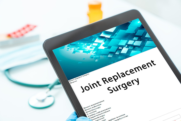 Joint replacement surgery Joint replacement surgery. This is a surgical procedure that involves replacing a damaged or diseased joint with an artificial joint to relieve pain and improve mobility., by WLADIMIR BULGAR SCIENCE PHOTO LIBRARY