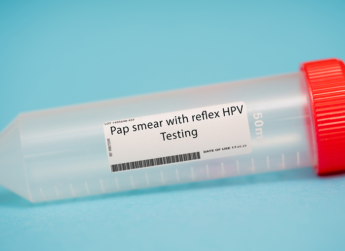 Pap smear with reflex HPV testing Pap smear with reflex HPV testing. This test combines a traditional pap smear with an HPV test. if abnormal cells are found on the pap smear, the HPV test is automatically performed to determine if HPV is present. This test is more sensitive than a traditional pap smear alone., by WLADIMIR BULGAR SCIENCE PHOTO LIBRARY