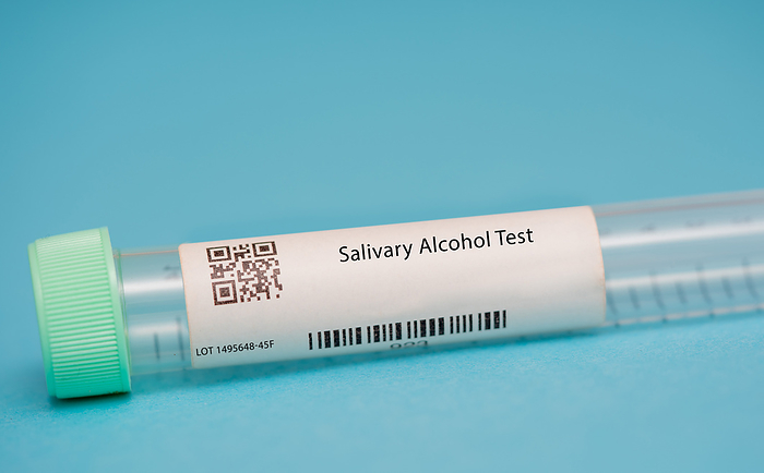 Salivary alcohol test Salivary alcohol test. This test measures the levels of alcohol in the saliva. It is used to assess alcohol consumption and monitor certain medical conditions, such as alcoholism and liver disease., by WLADIMIR BULGAR SCIENCE PHOTO LIBRARY