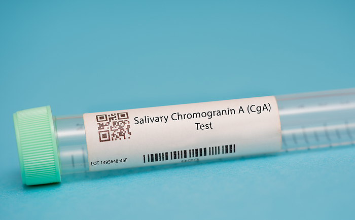 Salivary chromogranin A test Salivary chromogranin A  CGA  test. This test measures the levels of CGA, a protein that is involved in the body s stress response, in the saliva. It is used to assess stress levels and monitor certain medical conditions, such as cardiovascular disease and neuroendocrine tumours., by WLADIMIR BULGAR SCIENCE PHOTO LIBRARY