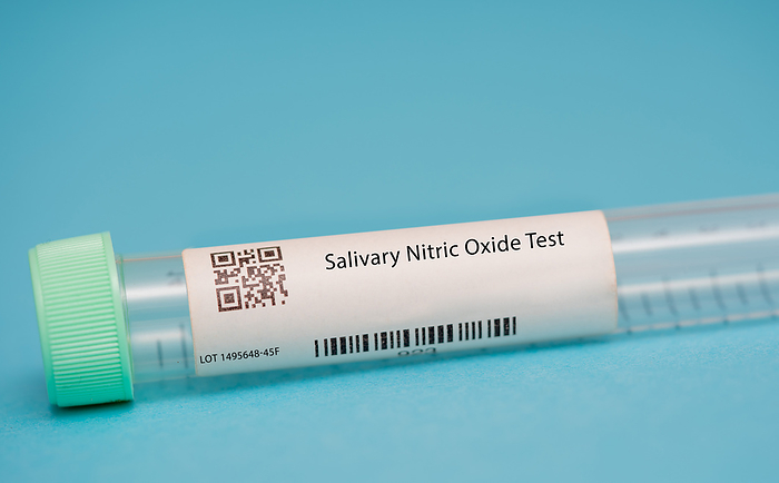 Salivary nitric oxide test Salivary nitric oxide test. This test measures the levels of nitric oxide, a gas that is involved in blood vessel dilation and other physiological processes, in the saliva. It is used to assess cardiovascular health and monitor certain medical conditions, such as asthma and inflammatory bowel disease  IBD ., by WLADIMIR BULGAR SCIENCE PHOTO LIBRARY