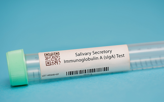 Salivary secretory immunoglobulin A test Salivary secretory immunoglobulin A  SIGA  test. This test measures the levels of siga, a type of antibody that is present in saliva and helps protect against infections, in the saliva. It is used to assess immune function and monitor certain medical conditions, such as autoimmune disorders and infections., by WLADIMIR BULGAR SCIENCE PHOTO LIBRARY