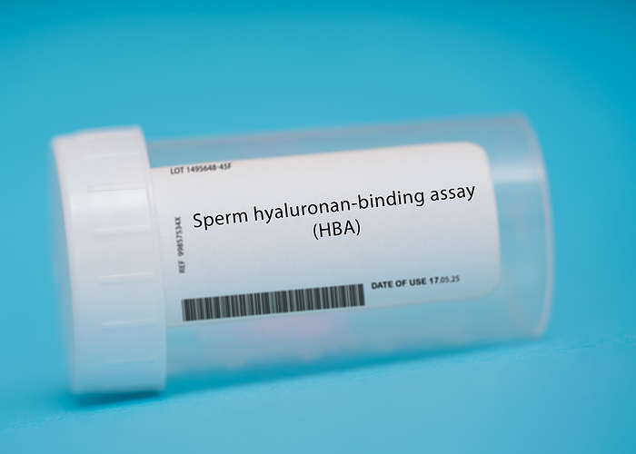 Sperm hyaluronan binding assay Sperm hyaluronan binding assay  HBA . This test measures the ability of sperm to bind to hyaluronan, a substance found in the follicular fluid surrounding the egg., by WLADIMIR BULGAR SCIENCE PHOTO LIBRARY