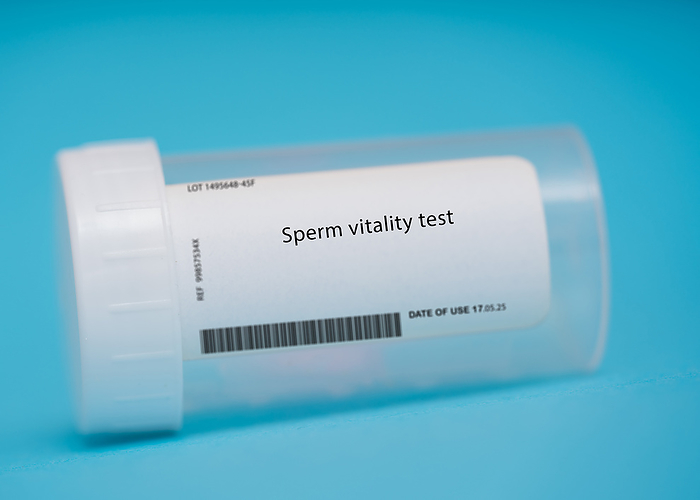 Sperm vitality test Sperm vitality test. This test measures the percentage of live sperm in a semen sample., by WLADIMIR BULGAR SCIENCE PHOTO LIBRARY
