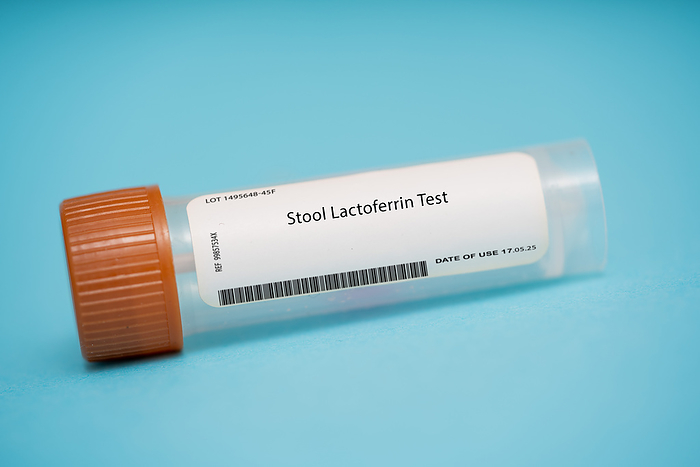 Stool lactoferrin test Stool lactoferrin test. This test measures the level of lactoferrin, a protein found in white blood cells, in the stool. elevated levels can be indicative of inflammation in the gastrointestinal tract., by WLADIMIR BULGAR SCIENCE PHOTO LIBRARY