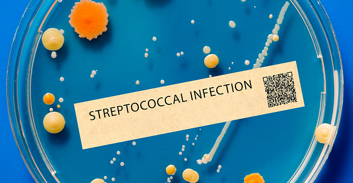 Streptococcal infection Streptococcal infection. This is a bacterial infection that can cause strep throat, scarlet fever, and other illnesses., by WLADIMIR BULGAR SCIENCE PHOTO LIBRARY