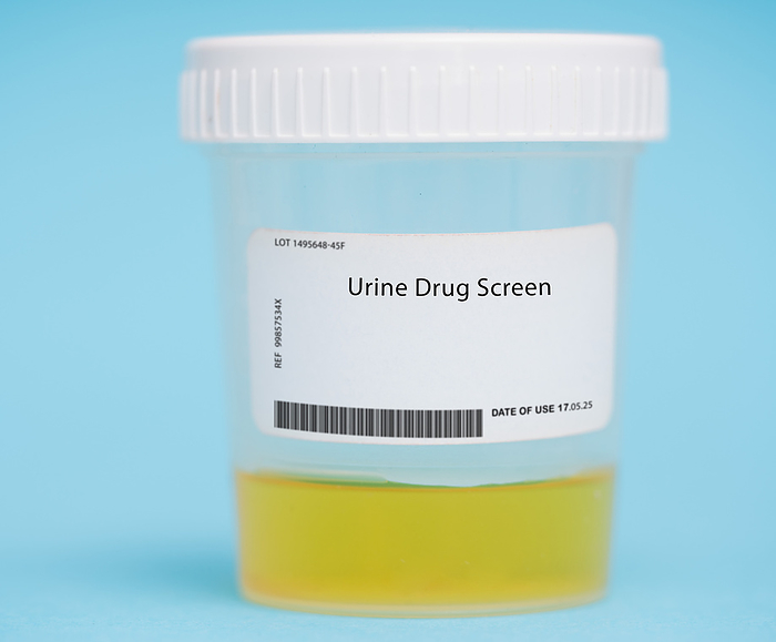 Urine drug screen Urine drug screen. This test measures the presence of drugs or their metabolites in the urine and is used to monitor medication levels, detect drug abuse, or assess drug interactions., by WLADIMIR BULGAR SCIENCE PHOTO LIBRARY