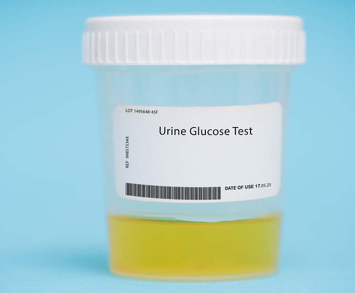Urine glucose test Urine glucose test. This test measures the levels of glucose, a sugar that is normally present in the urine in small amounts. It is used to monitor people with diabetes and other conditions that can cause high levels of glucose in the urine., by WLADIMIR BULGAR SCIENCE PHOTO LIBRARY