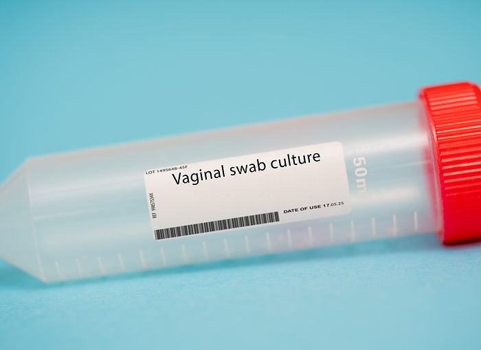 Vaginal swab culture Vaginal swab culture. A vaginal swab culture is a diagnostic test that is used to identify the presence of bacterial, fungal or viral infections in the vagina. A sample of vaginal discharge is collected and sent to a laboratory for analysis., by WLADIMIR BULGAR SCIENCE PHOTO LIBRARY