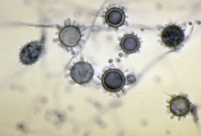 Histoplasma capsulatum fungi, light micrograph Light micrograph showing the conidia  asexual spores  from a Histoplasma capsulatum fungus. Two types of conidia are visible: microconidia  small circles  and macroconidia  large circles with protrusions . This fungus is mostly found in soil, especially where bat and bird droppings are present. The spores can causes the disease histoplasmosis when inhaled. In most cases, people are not affected when they inhale these spores, but in some cases develop a fever, cough, and fatigue which typically self resolve. In rare cases, particularly when patients are immunosuppressed, severe histoplasmosis can develop, and potentially affect almost any part of the body. This can lead to respiratory or bone marrow failure which can be fatal. Antifungal medication is the typical treatment course when necessary., by CDC SCIENCE PHOTO LIBRARY
