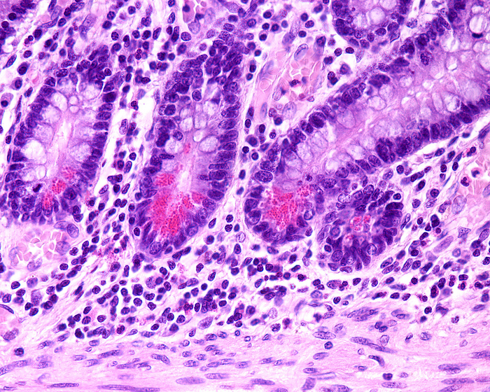 Small intestine Paneth cells, light micrograph Light micrograph of Paneth cells showing very large eosinophilic granulations. They are located at the bottom of a Lieberkuhn crypt of the small intestine. Paneth cells are part of the innate immune system. They secrete anti microbial compounds  as defensins and lysozyme  controlling the enteric bacteria., by JOSE CALVO   SCIENCE PHOTO LIBRARY