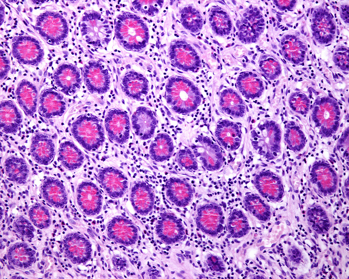 Small intestine Paneth cells, light micrograph Light micrograph of cross sectioned Lieberkuhn crypts showing Paneth cells with very large eosinophilic granulations. Paneth cells are part of the innate immune system. They secrete anti microbial compounds  as defensins and lysozyme  controlling the enteric bacteria., by JOSE CALVO   SCIENCE PHOTO LIBRARY