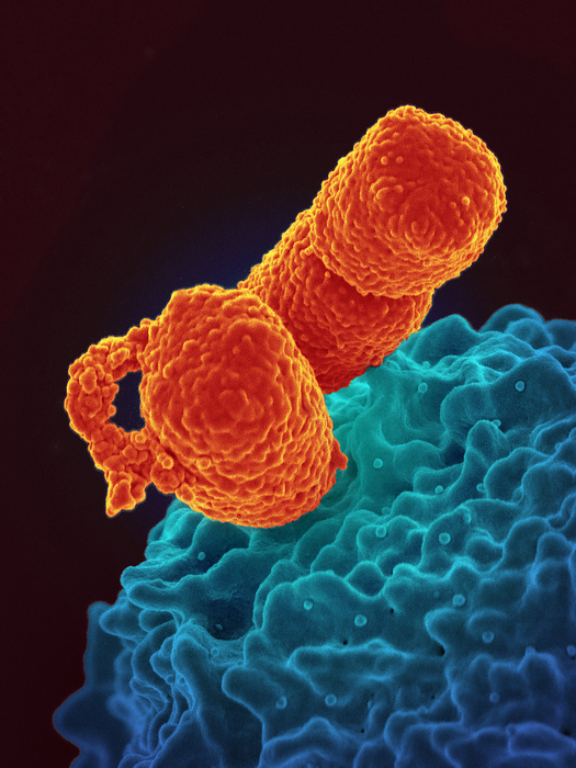 White blood cell interacting with Klebsiella pneumoniae bacteria, SEM Coloured scanning electron micrograph  SEM  of a neutrophil  white blood cell, blue  interacting with Klebsiella pneumoniae bacteria  orange . Klebsiella is commonly found in human intestines and under normal conditions does not cause any harm. It can cause severe opportunistic infections however, especially in people receiving certain hospital treatments. These infections include pneumonia, meningitis, blood infections and infections of surgical wounds. It is resistant to multiple drugs, but infections can be treated with certain antibiotics., by NIAID SCIENCE PHOTO LIBRARY