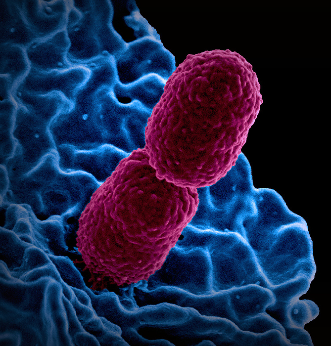 White blood cell interacting with Klebsiella pneumoniae bacterium, SEM Coloured scanning electron micrograph  SEM  of a neutrophil  white blood cell, blue  interacting with Klebsiella pneumoniae bacteria  red . Klebsiella is commonly found in human intestines and under normal conditions does not cause any harm. It can cause severe opportunistic infections however, especially in people receiving certain hospital treatments. These infections include pneumonia, meningitis, blood infections and infections of surgical wounds. It is resistant to multiple drugs, but infections can be treated with certain antibiotics., by NIAID SCIENCE PHOTO LIBRARY