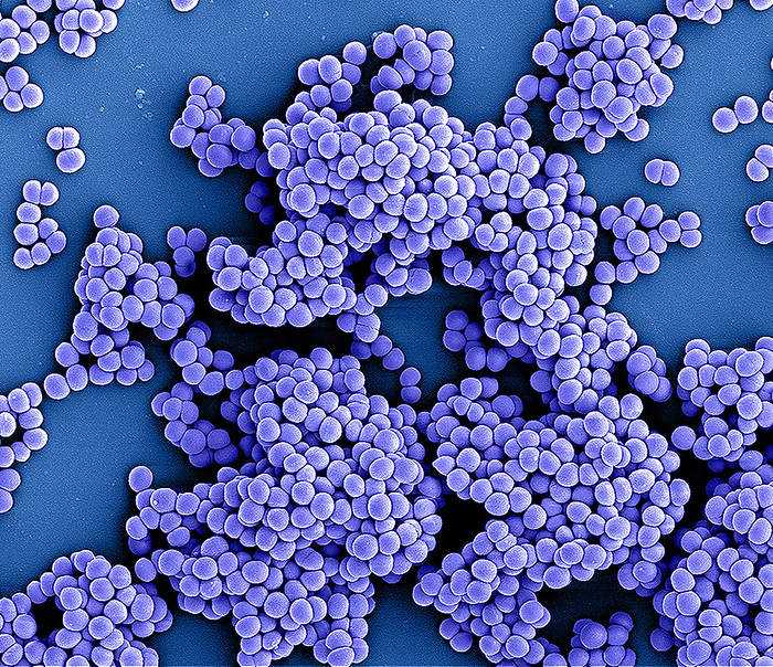 Methicillin resistant Staphylococcus aureusbacteria, SEM Coloured scanning electron micrograph  SEM  of methicillin resistant Staphylococcus aureus  MRSA  bacteria. MRSA is a gram positive, round  coccus  bacterium. It is resistant to many commonly prescribed antibiotics. S. aureus is carried by around 30 percent of the population without causing any symptoms. In vulnerable people, such as those that have recently had surgery, it can cause wound infections, pneumonia and blood poisoning. Specific antibiotics, often administered intravenously, can be used to treat MRSA infections., by NIAID SCIENCE PHOTO LIBRARY